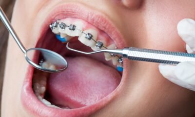 best orthodontist melbourne